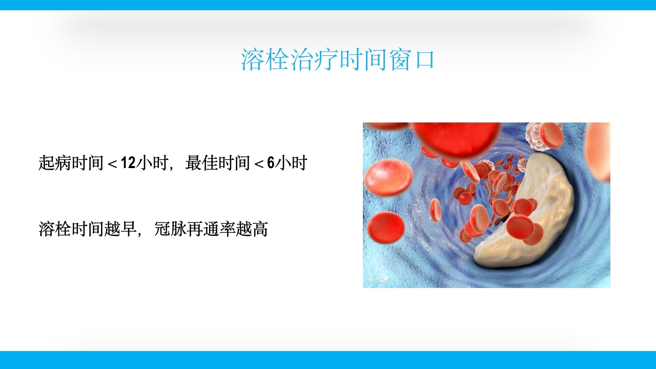 老年心绞痛PPT课件31