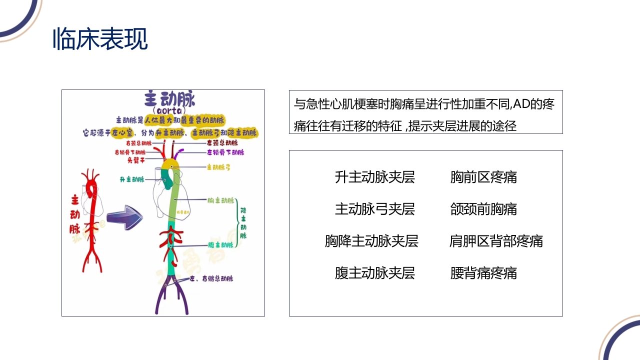 主动脉夹层PPT课件13