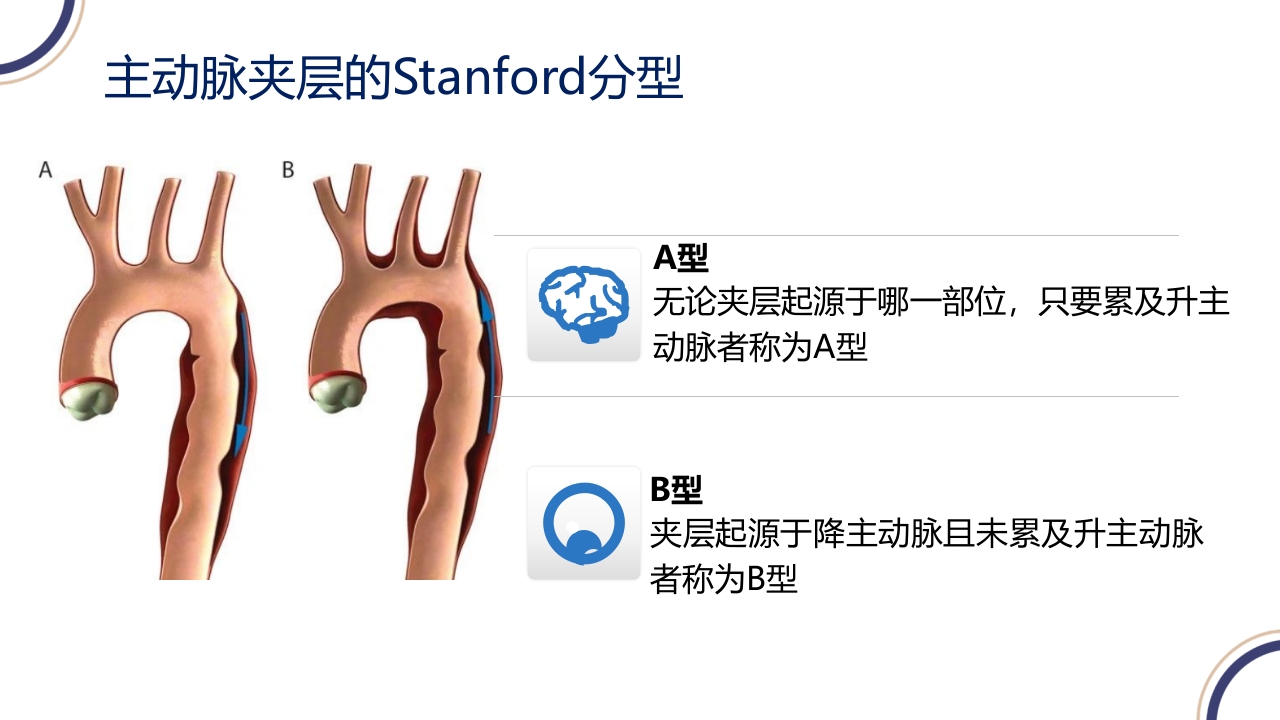 主动脉夹层PPT课件22