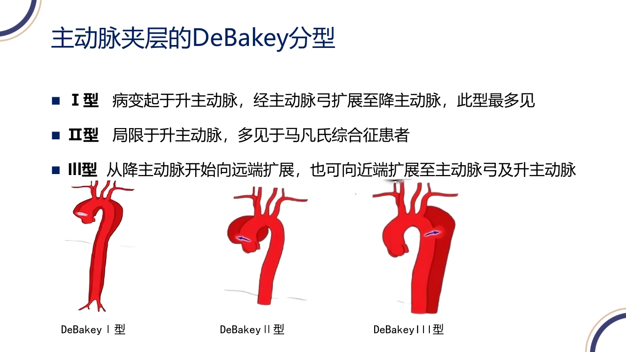 主动脉夹层PPT课件23