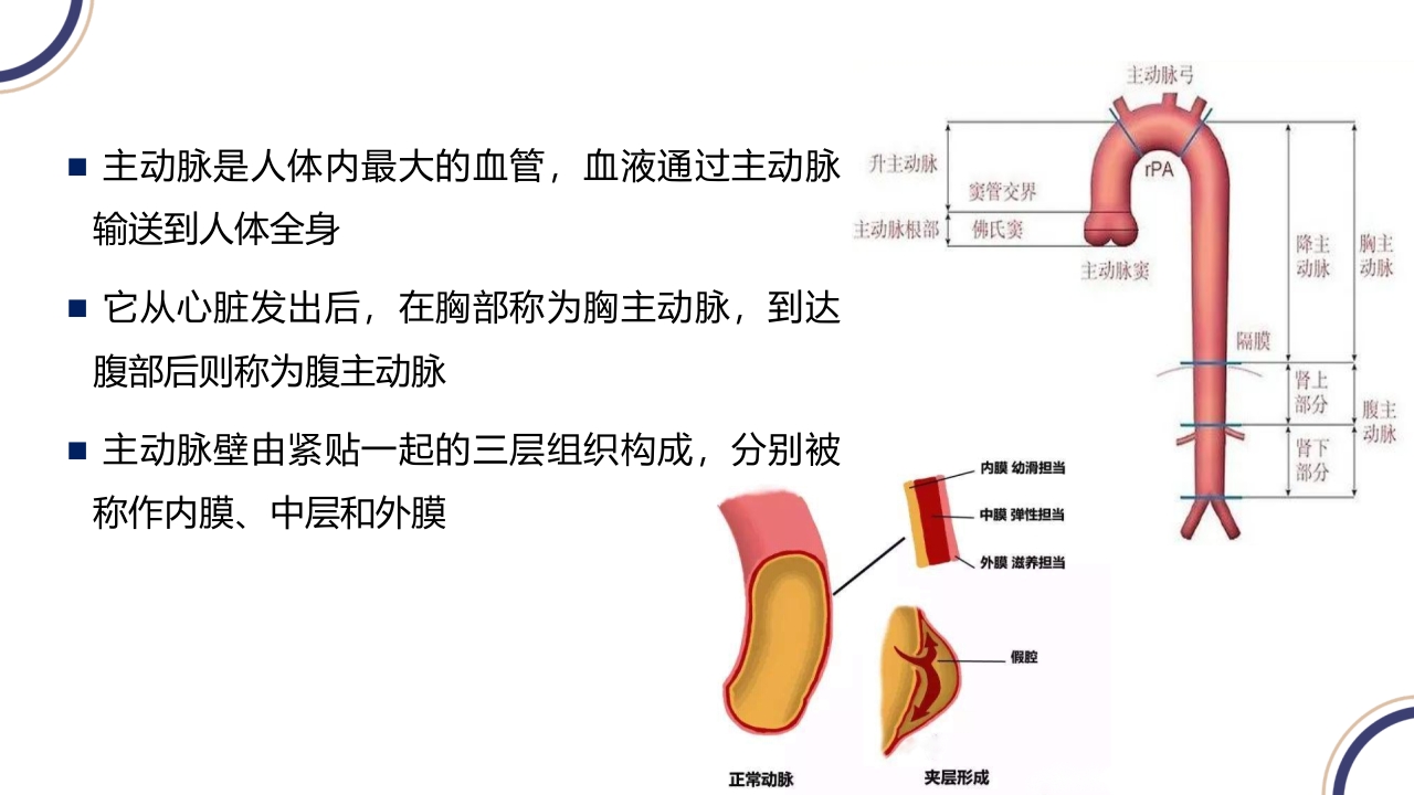 主动脉夹层PPT课件4