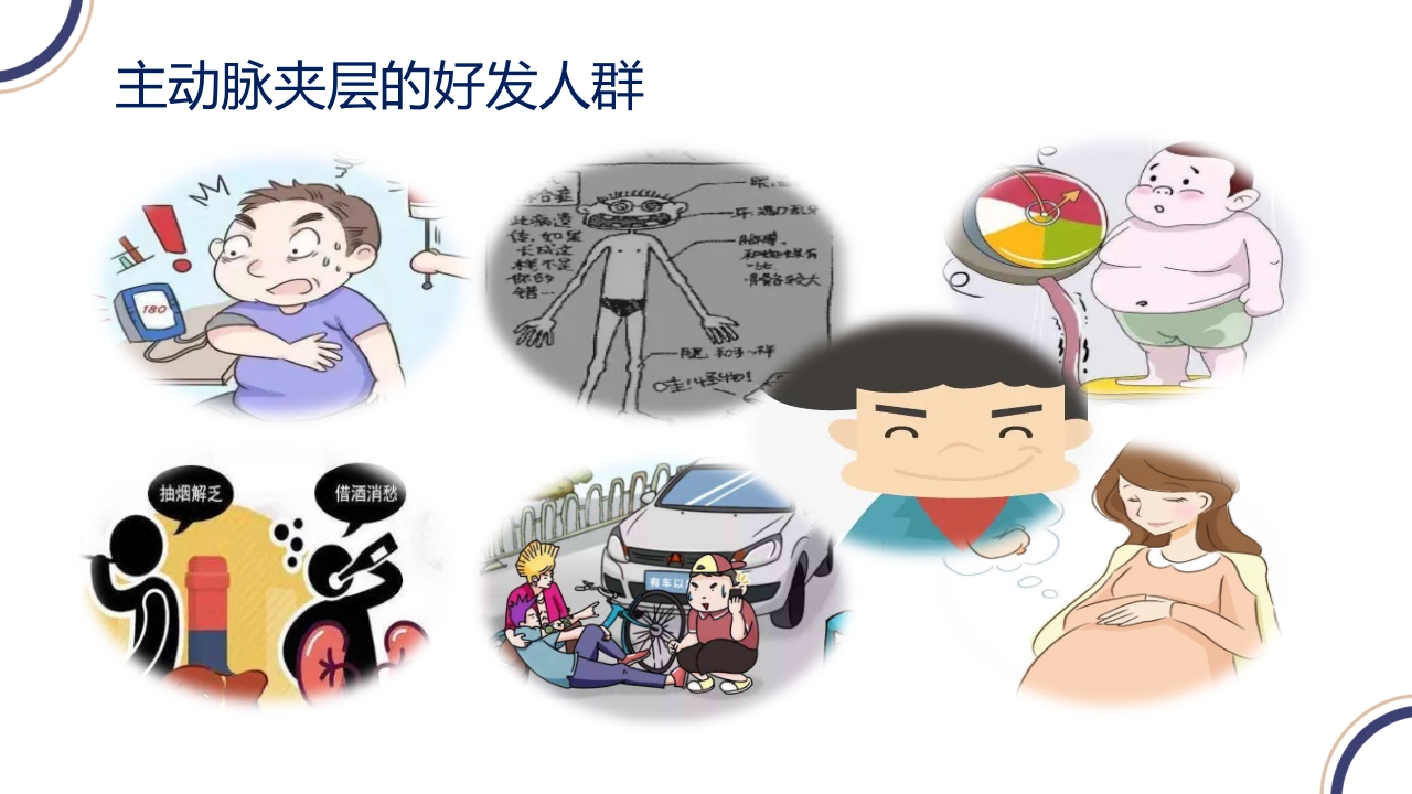 主动脉夹层PPT课件9