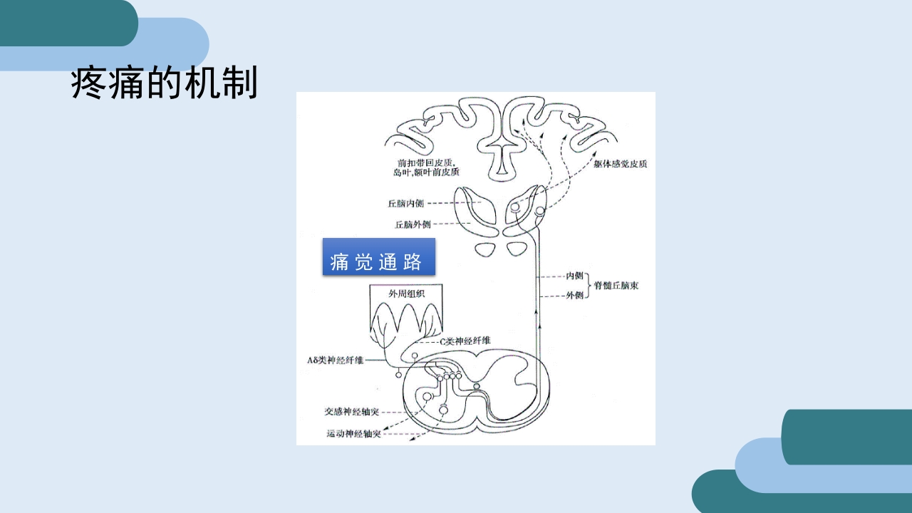 疼痛护理查房PPT课件5