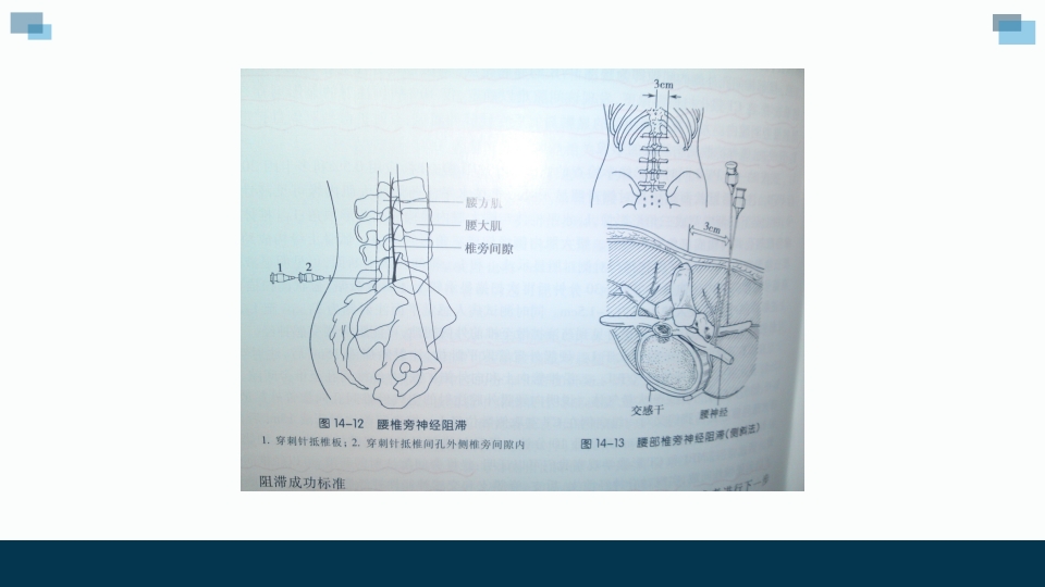 一例卵巢癌癌痛病人的个案汇报护理查房PPT课件12