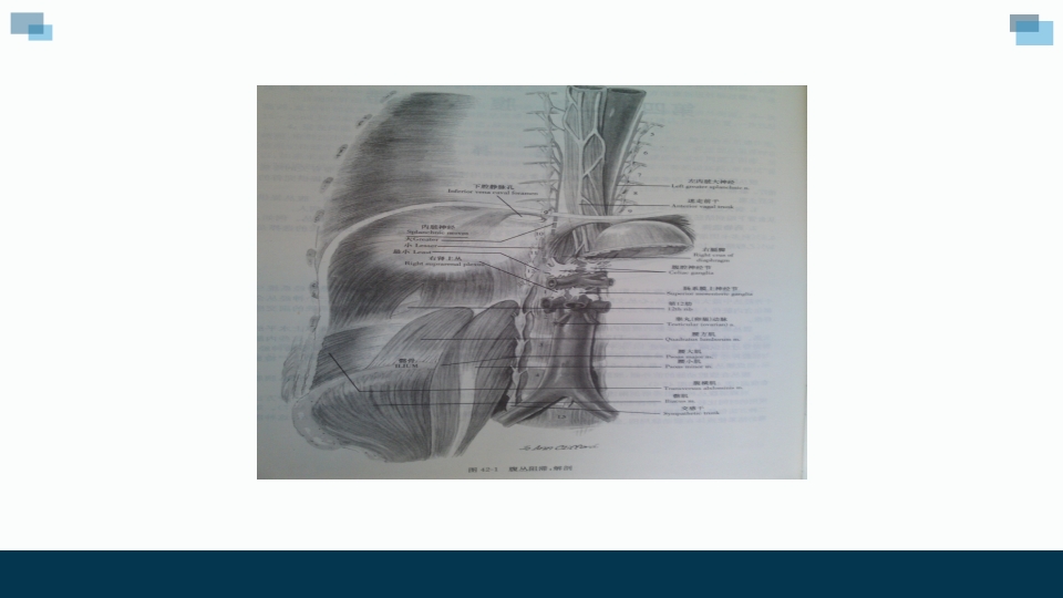 一例卵巢癌癌痛病人的个案汇报护理查房PPT课件13