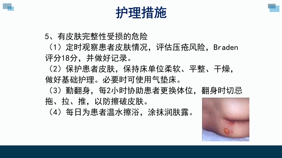 一例卵巢癌癌痛病人的个案汇报护理查房PPT课件31