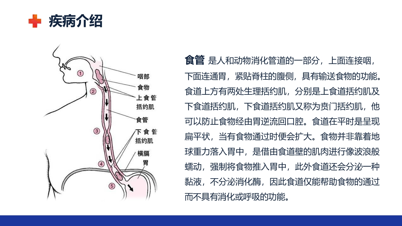 食管癌的护理查房ppt课件4