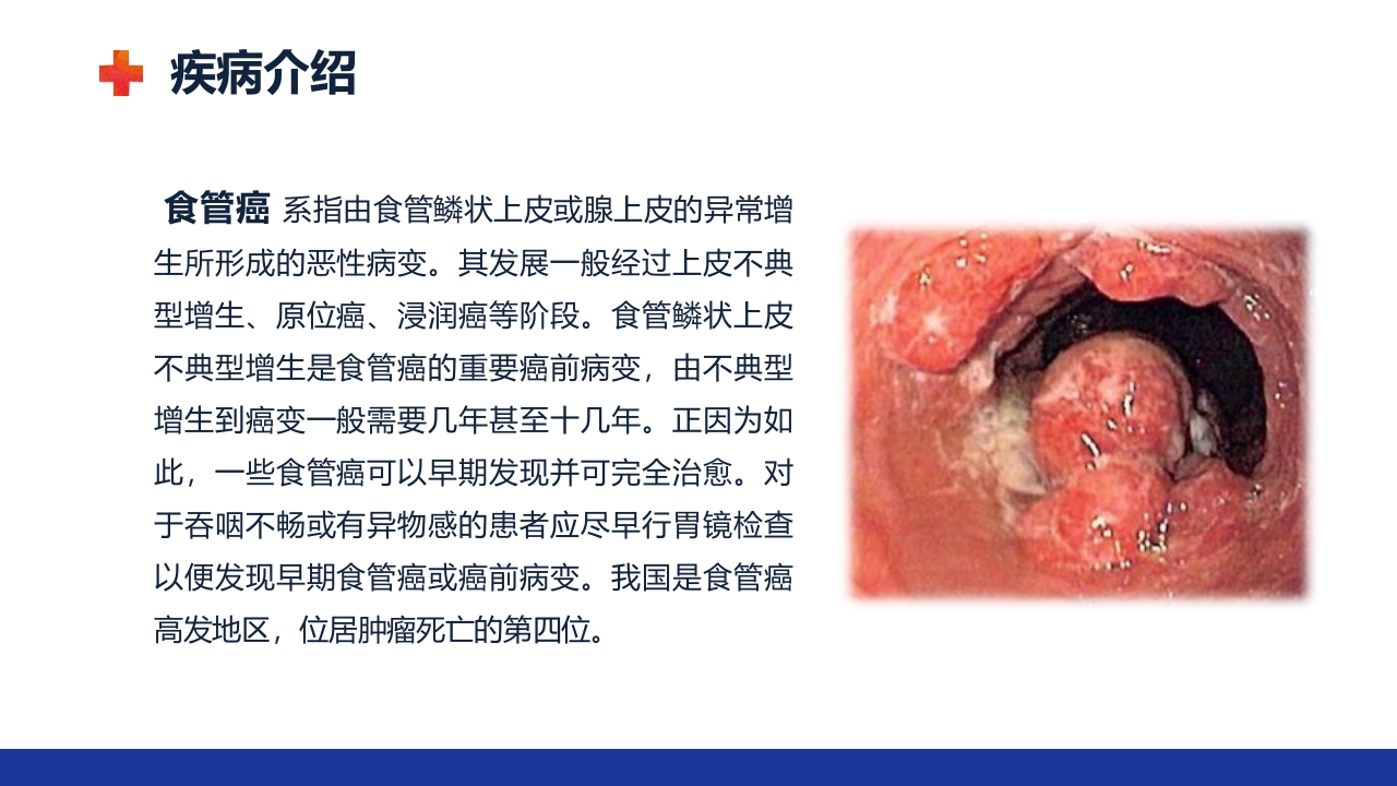 食管癌的护理查房ppt课件5