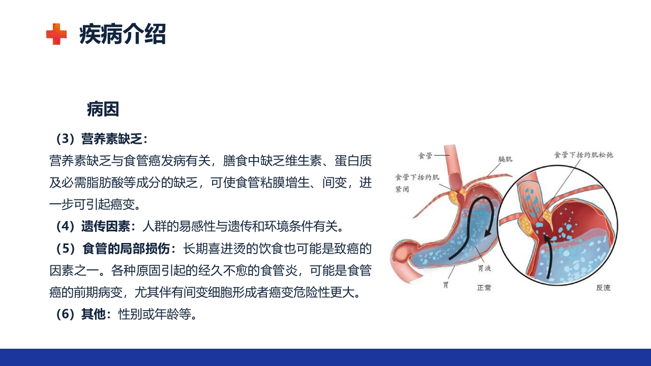 食管癌的护理查房ppt课件8