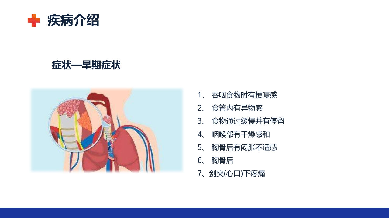 食管癌的护理查房ppt课件9