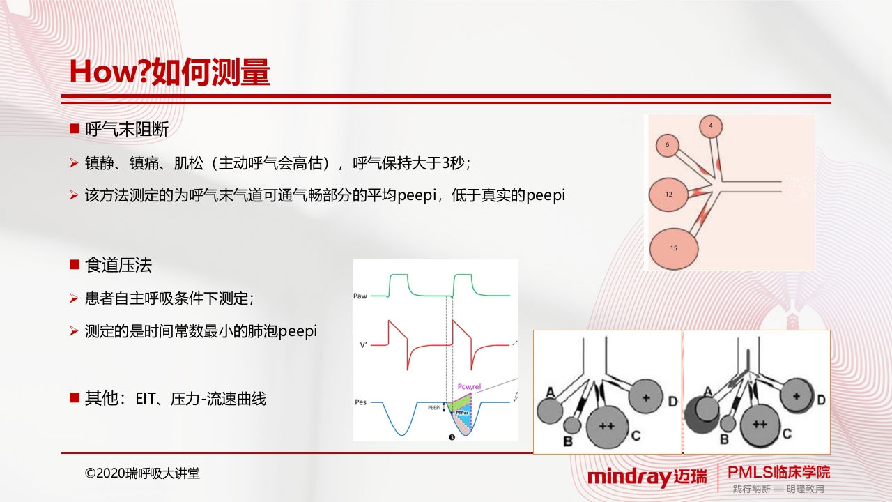 内源性peepPPT课件10