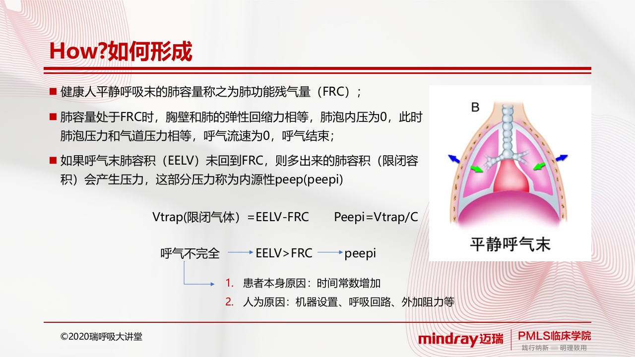 内源性peepPPT课件4