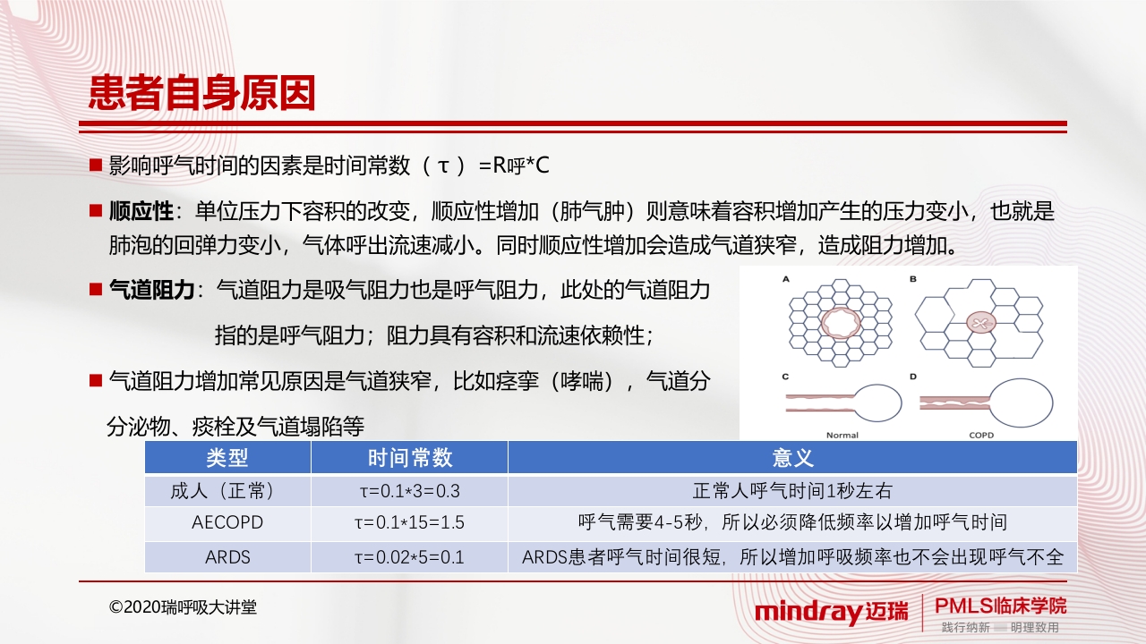内源性peepPPT课件5