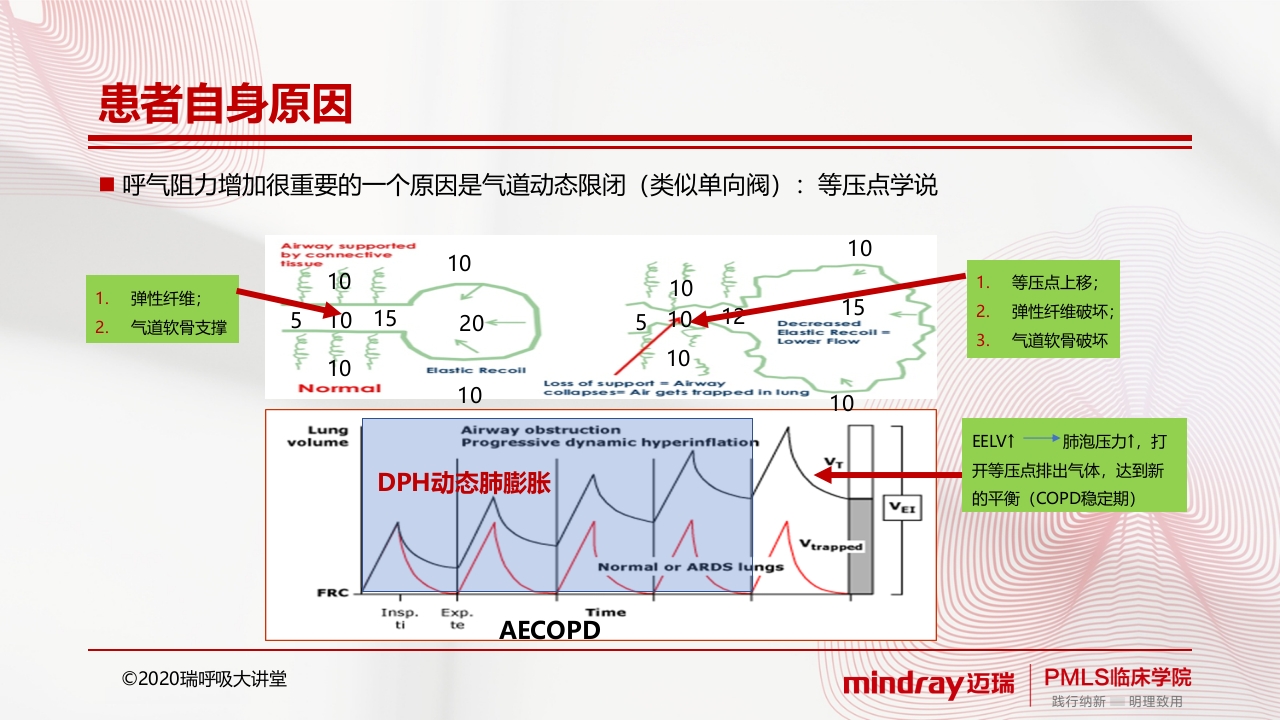 内源性peepPPT课件6