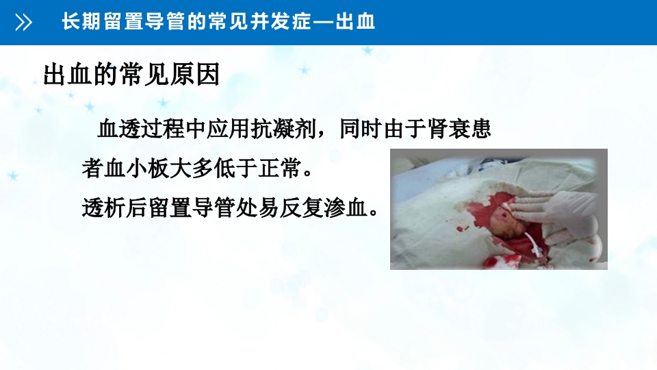 血液透析留置导管护理PPT课件29