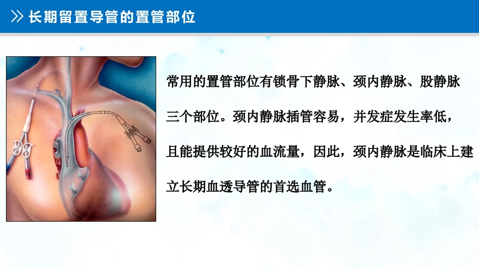 血液透析留置导管护理PPT课件7
