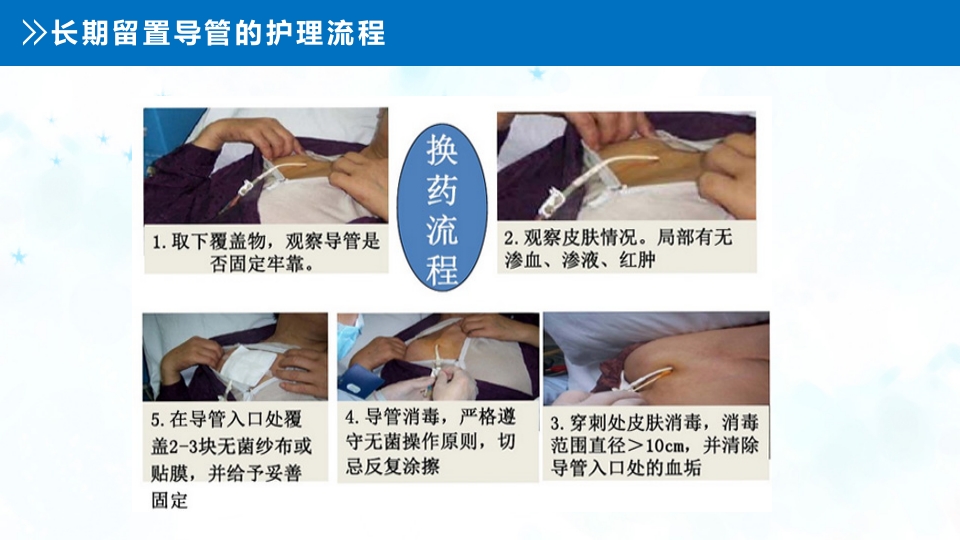 血液透析留置导管护理PPT课件8