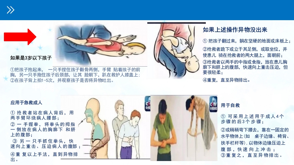 认知障碍患者进食问题评估与护理PPT课件26