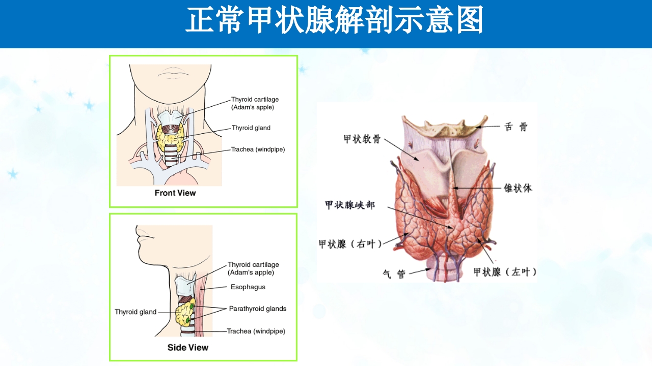 甲亢PPT课件3