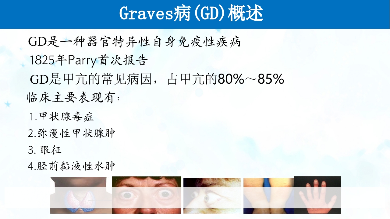 甲亢PPT课件9