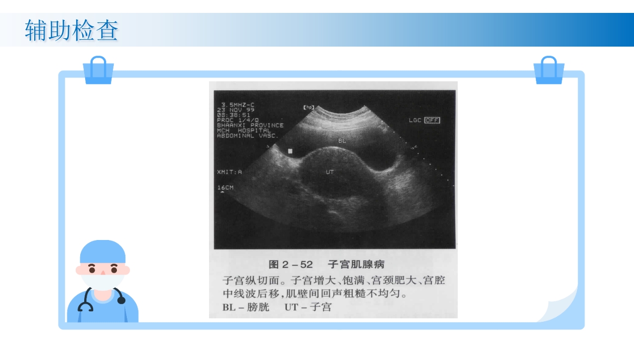 子宫腺肌症诊断及治疗PPT课件15