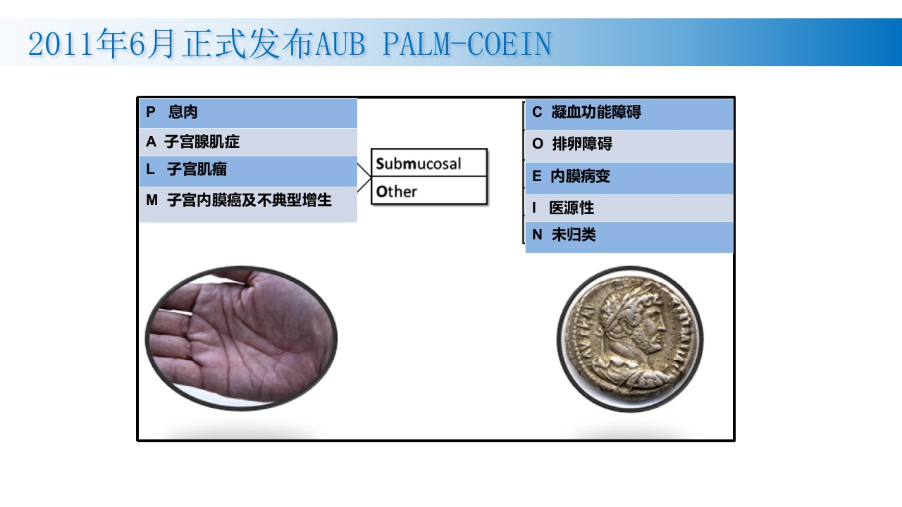 子宫腺肌症诊断及治疗PPT课件3