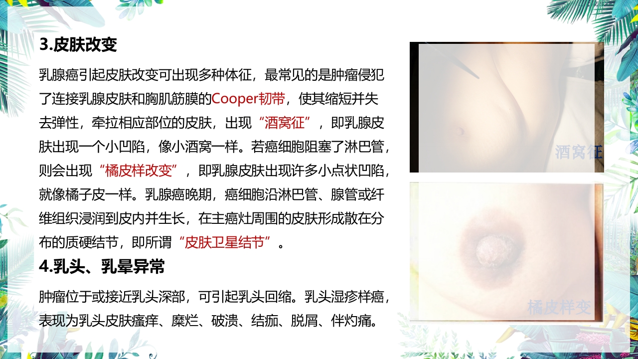 乳癌改良根治术护理配合PPT课件9