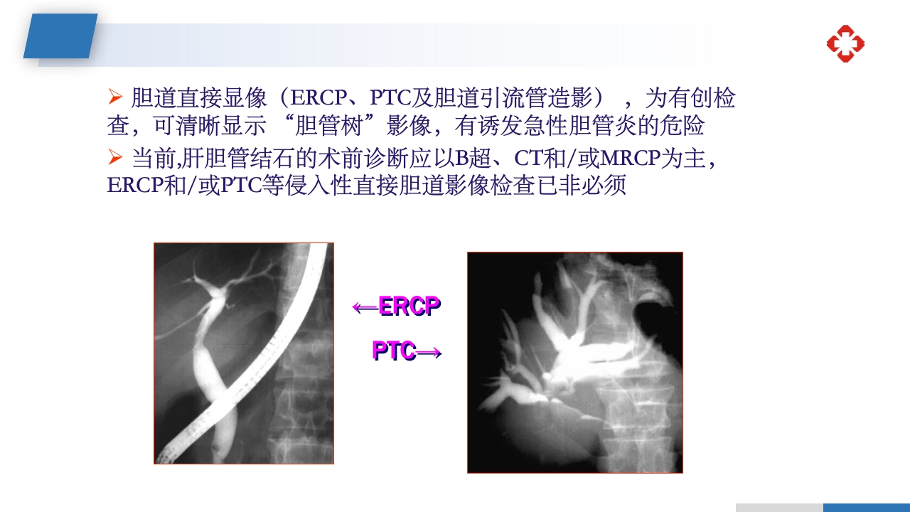 肝内胆管结石护理查房PPT课件18