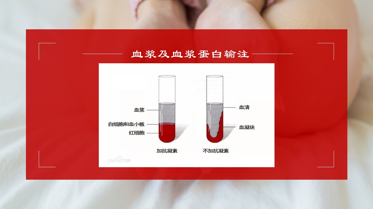 成分输血及输血规范培训医学PPT课件15