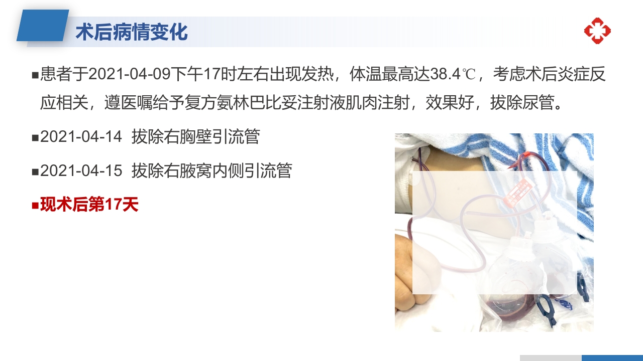 乳腺癌根治术后护理查房PPT课件28