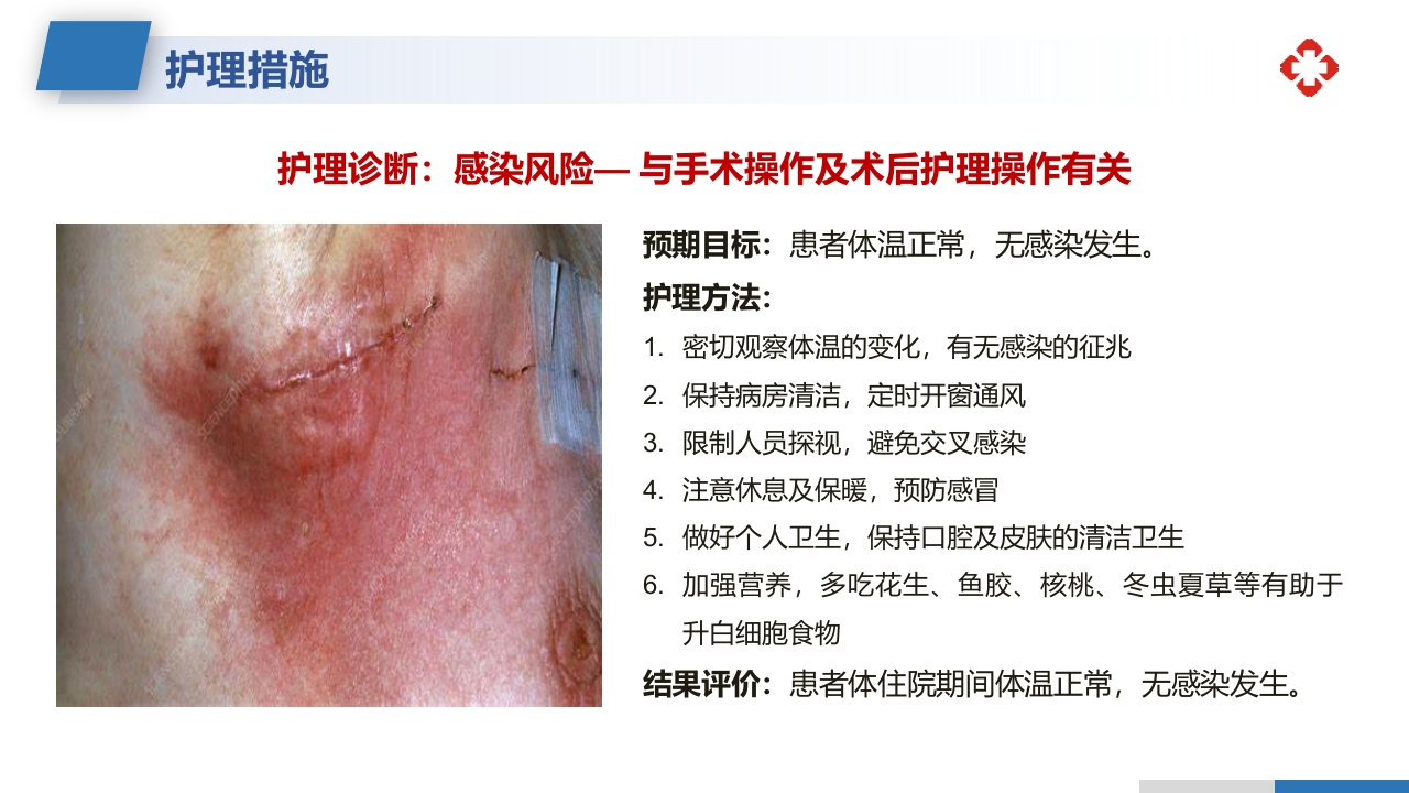 乳腺癌根治术后护理查房PPT课件38