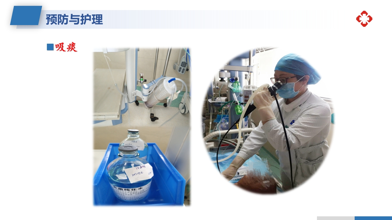 坠积性肺炎的预防与护理措施PPT课件13