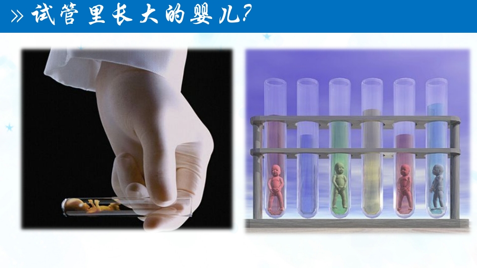 试管婴儿技术PPT课件3