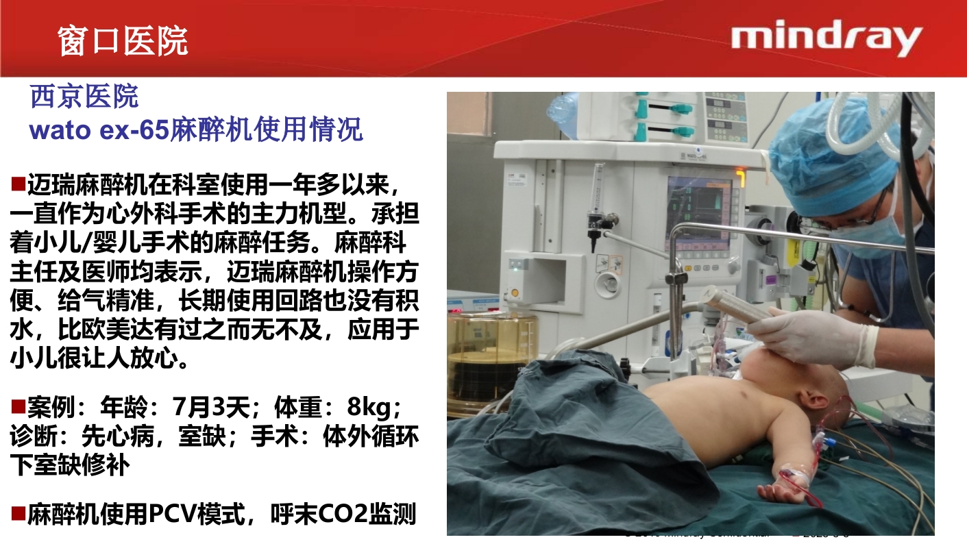 迈瑞麻醉机介绍PPT课件57