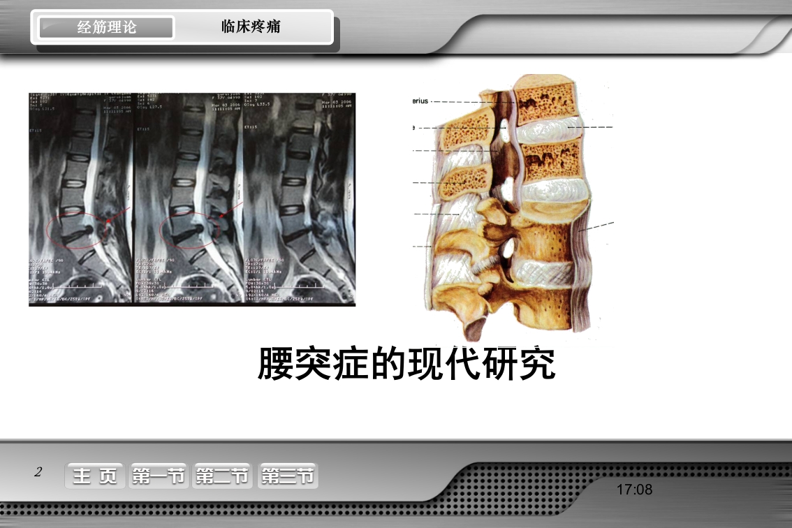 腰骶经筋解剖PPT课件2