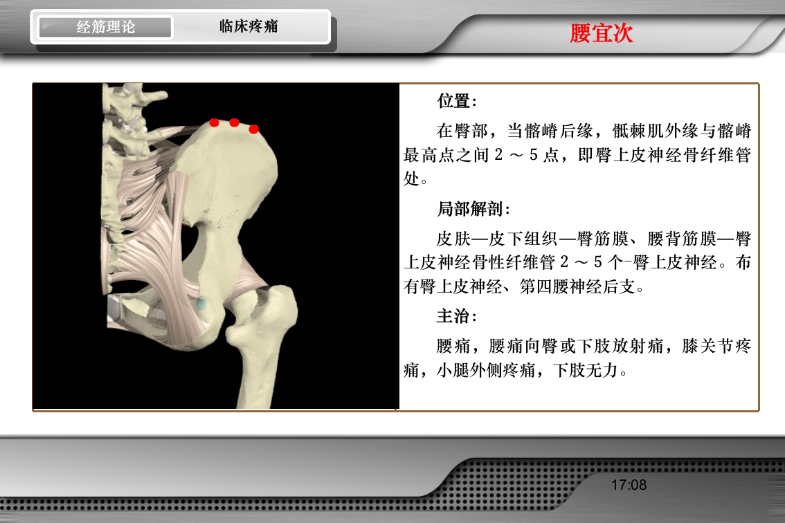 腰骶经筋解剖PPT课件59