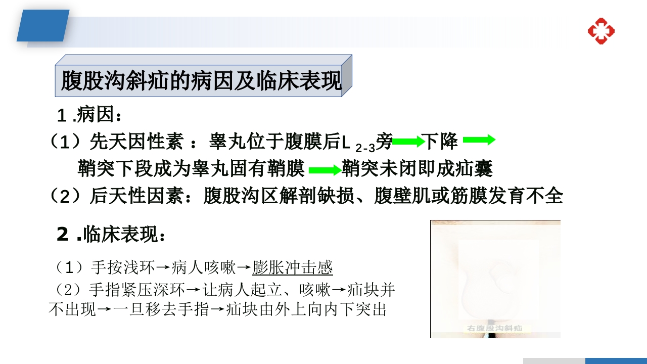 腹外疝病人的护理PPT课件13