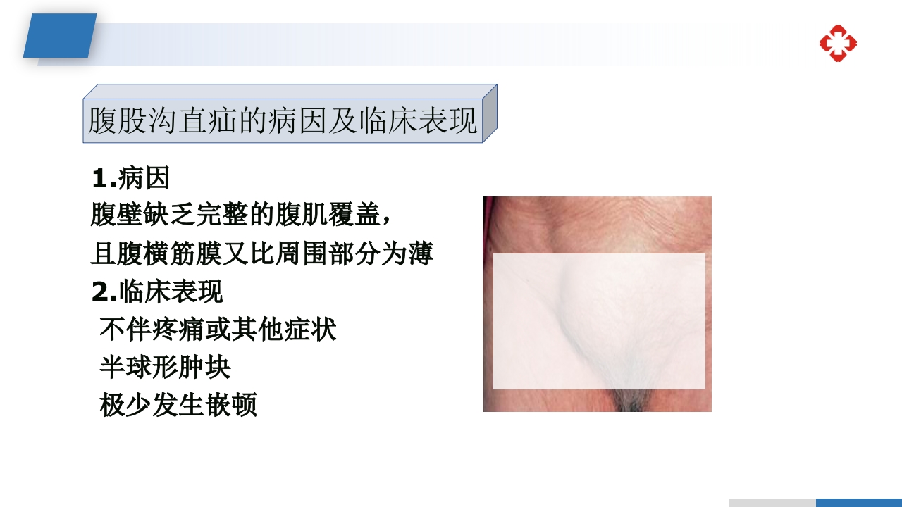 腹外疝病人的护理PPT课件18