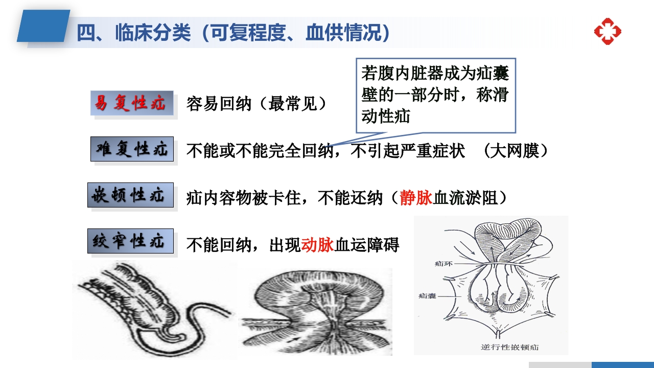 腹外疝病人的护理PPT课件5