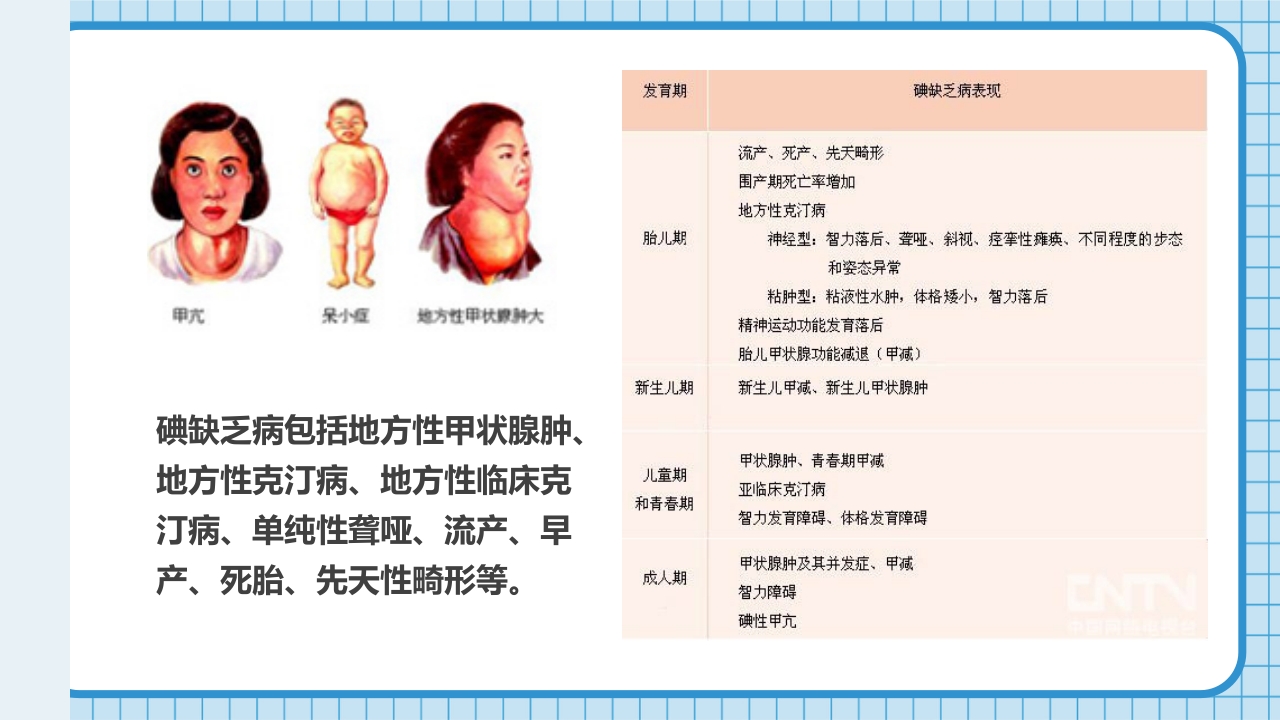 防治碘缺乏病日知识讲座PPT课件10