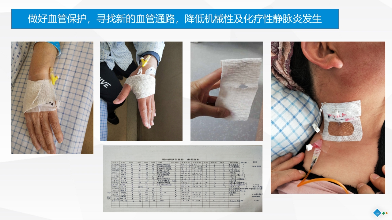 PDCA-降低血液肿瘤患者住院化疗期间静脉炎的发生率PPT课件36