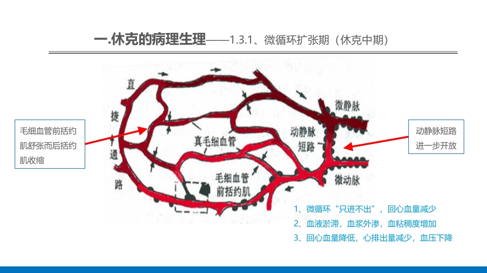 外科休克的概述PPT课件12