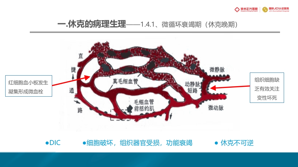 外科休克的概述PPT课件14