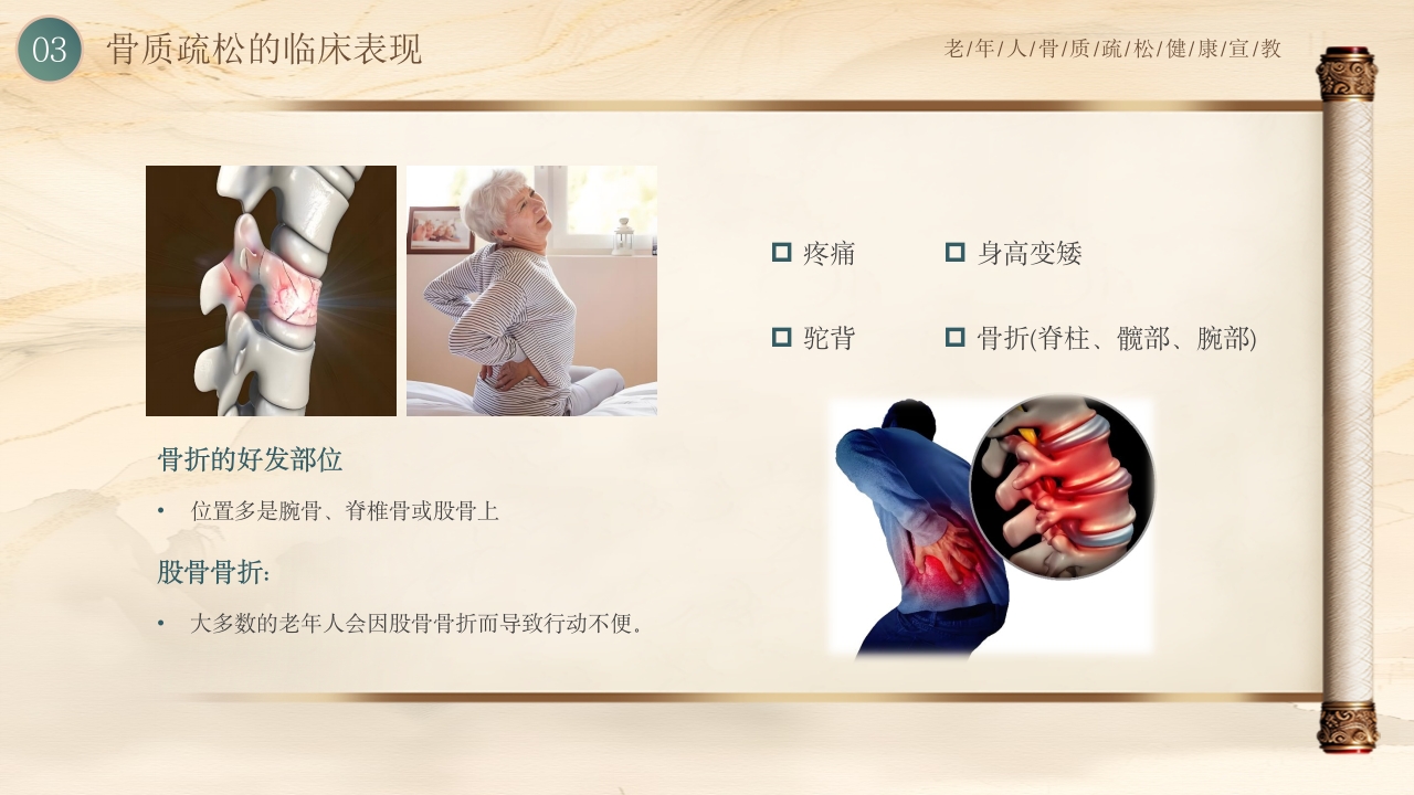老年人骨质疏松健康教育PPT课件10
