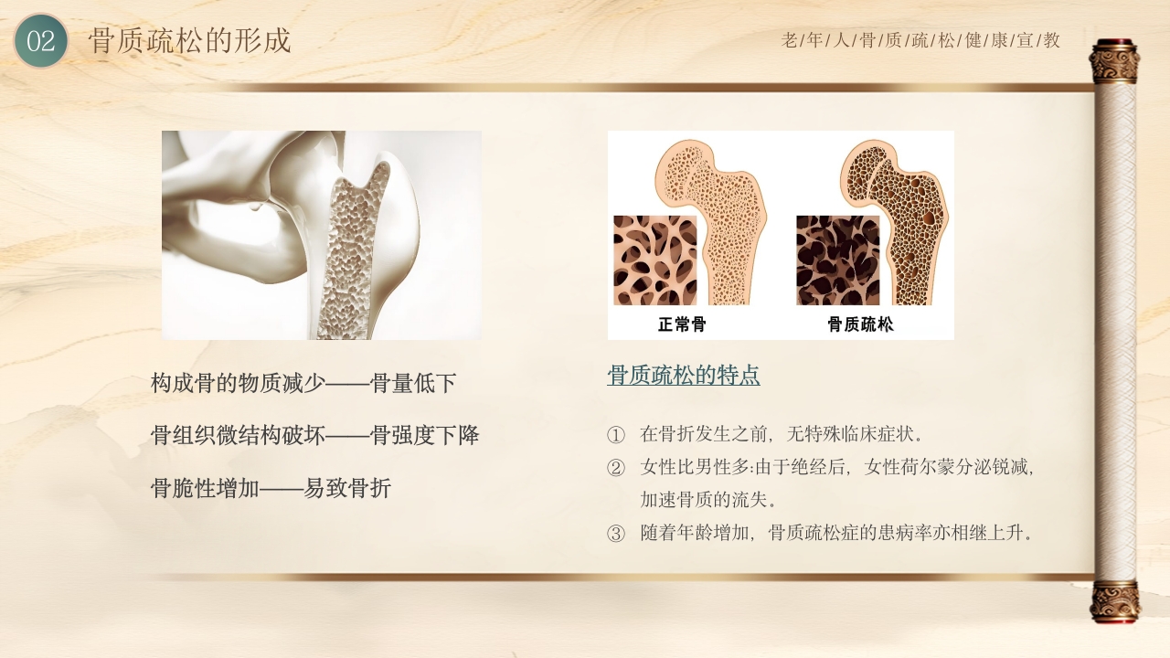 老年人骨质疏松健康教育PPT课件7