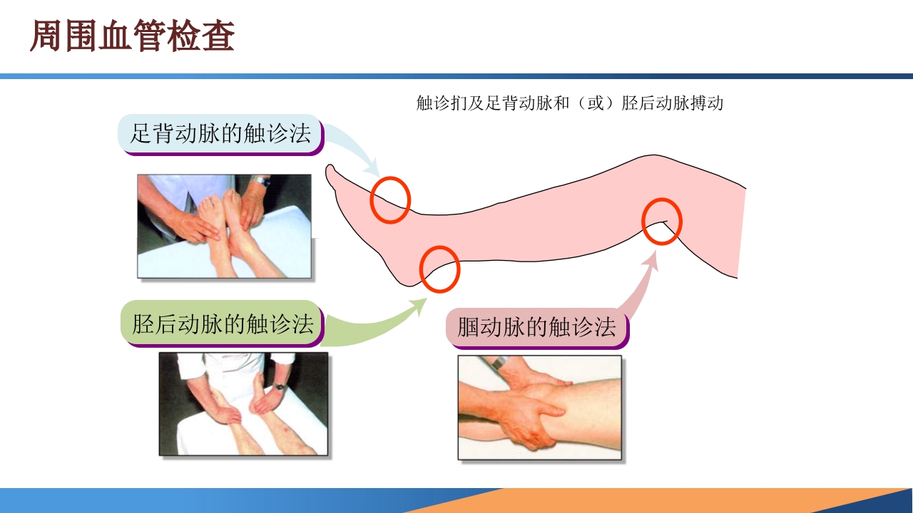 糖尿病患者合并周围动脉病变的诊断PPT课件20