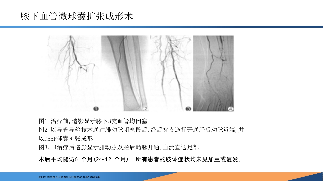 糖尿病患者合并周围动脉病变的诊断PPT课件29