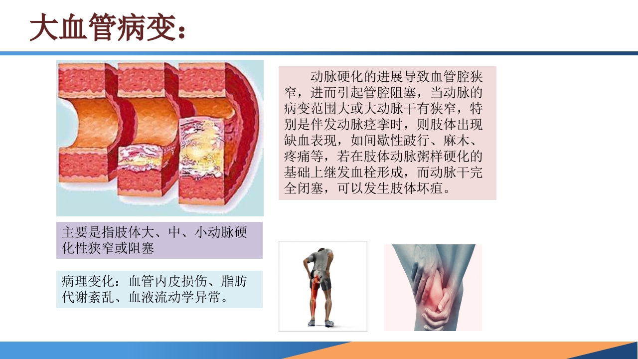 糖尿病患者合并周围动脉病变的诊断PPT课件4