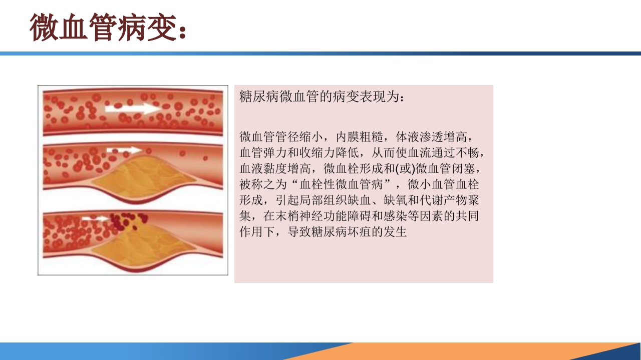糖尿病患者合并周围动脉病变的诊断PPT课件5