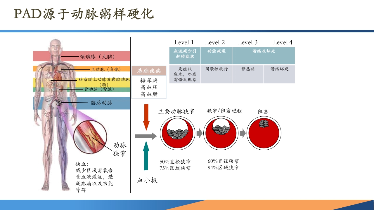 糖尿病患者合并周围动脉病变的诊断PPT课件6